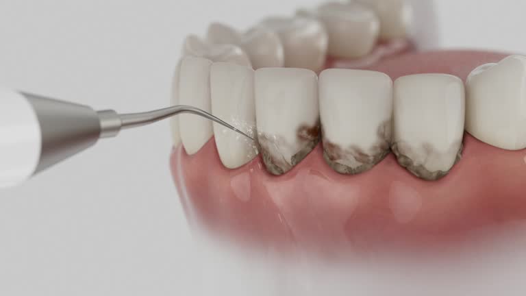 Reliable Dental Implants contractor in Plainview, NY by Smile Center Dentistry